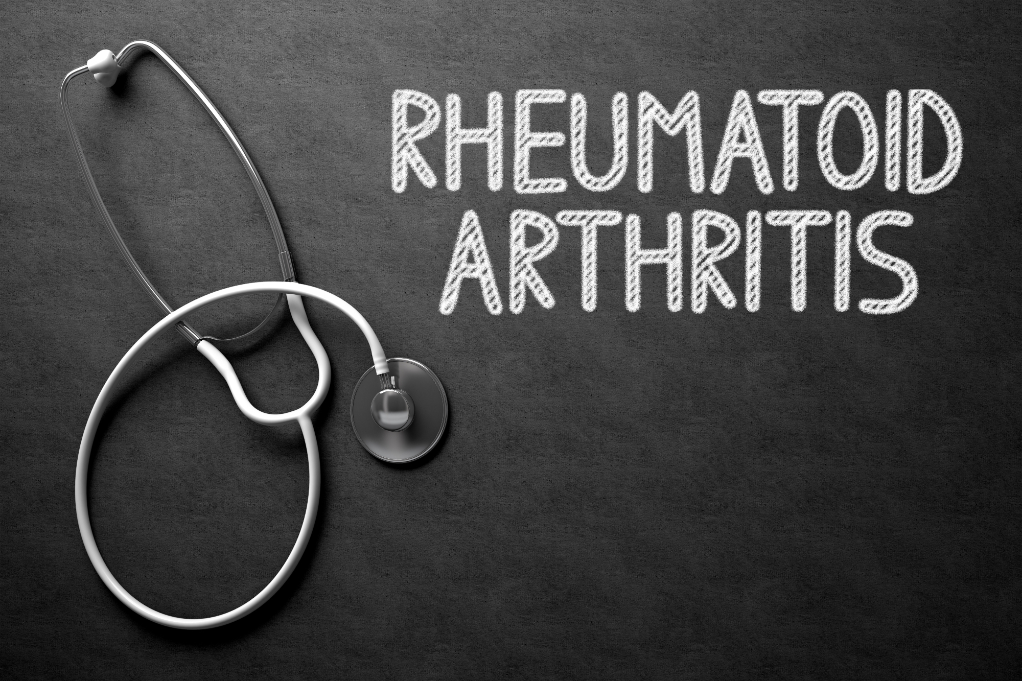 Revmatoidni artritis kot avtoimuna in zahrbtna bolezen